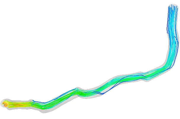 1. Intravascular Ultrasound - Ansys Fluent - velocity streamlines