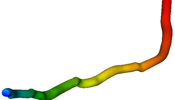 2. Intravascular Ultrasound - Ansys Fluent - pressure-thum