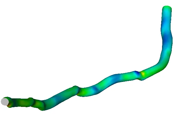 3. Intravascular Ultrasound - Ansys Fluent - wall shear force