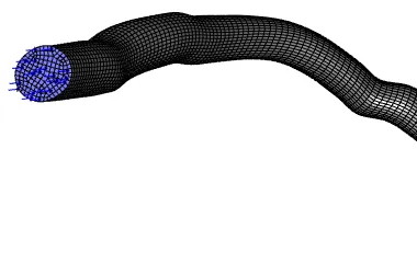 4. Intravascular Ultrasound - Ansys Meshing - mesh