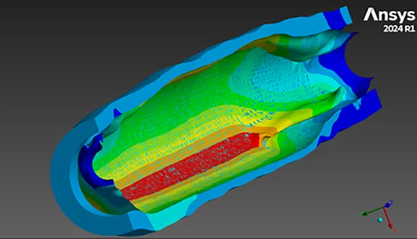 Balloon inflated in the artery